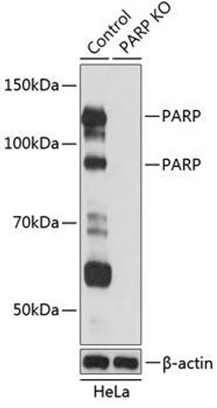 KO Validated Antibodies 2 Anti-PARP Antibody KO Validated CAB19596