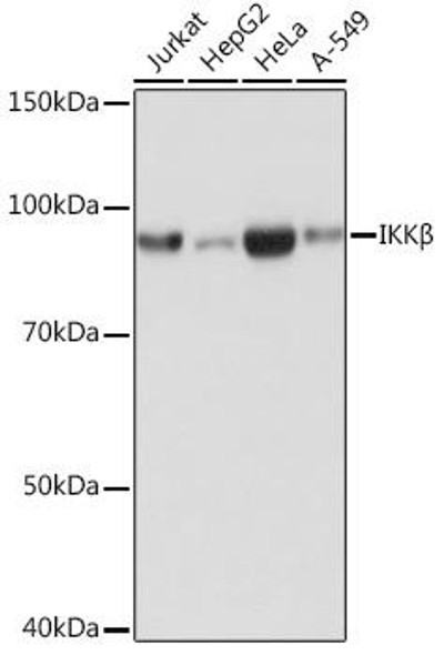 Immunology Antibodies 3 Anti-IKKBeta Antibody CAB19606