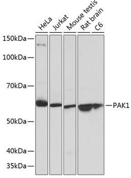 Cell Death Antibodies 2 Anti-PAK1 Antibody CAB19608