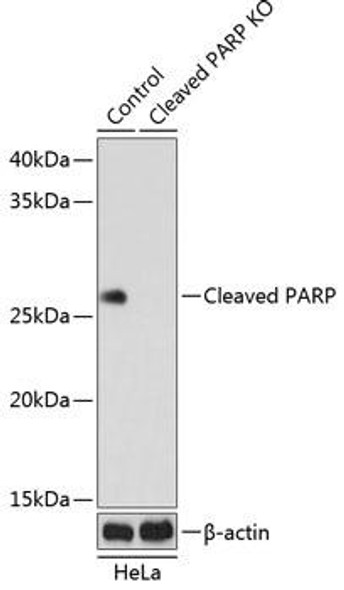 KO Validated Antibodies 2 Anti-Cleaved PARP p25 Antibody KO Validated CAB19612