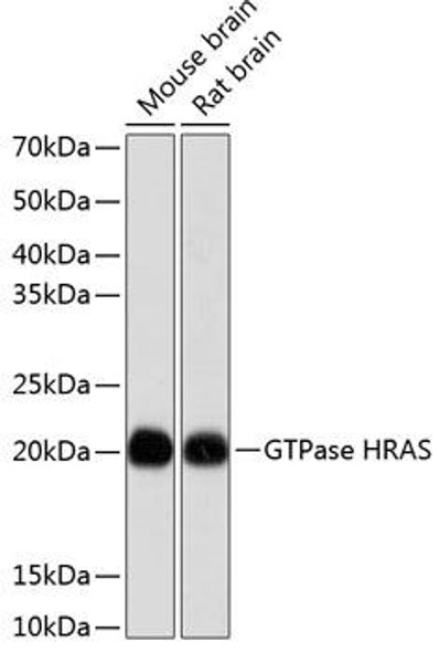 Cell Biology Antibodies 17 Anti-GTPase HRAS Antibody CAB19619
