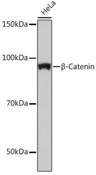 KO Validated Antibodies 2 Anti-Beta-Catenin Antibody KO Validated CAB19657