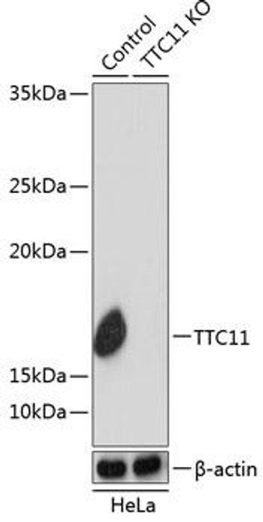 KO Validated Antibodies 2 Anti-TTC11 Antibody KO Validated CAB19666