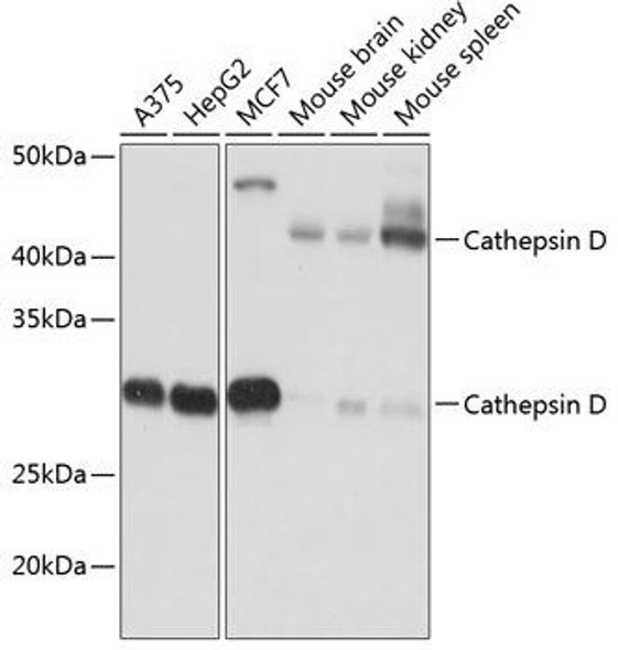 Cell Biology Antibodies 17 Anti-Cathepsin D Antibody CAB19680