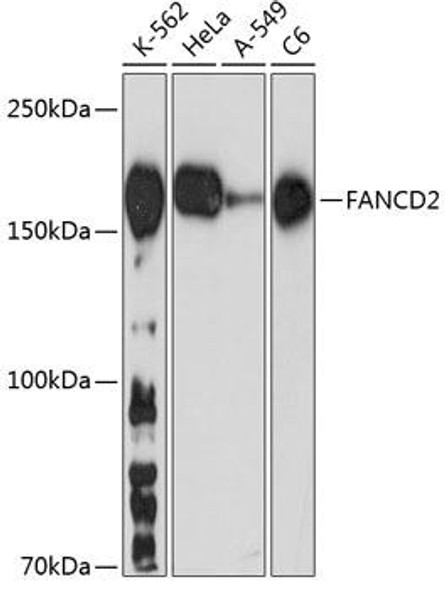 Cell Cycle Antibodies 2 Anti-FANCD2 Antibody CAB19692