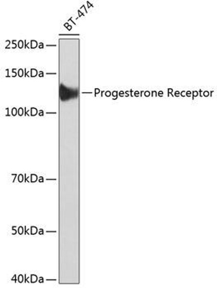 Epigenetics and Nuclear Signaling Antibodies 5 Anti-Progesterone Receptor Antibody CAB19697