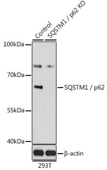 KO Validated Antibodies 2 Anti-SQSTM1 / p62 Antibody KO Validated CAB19700