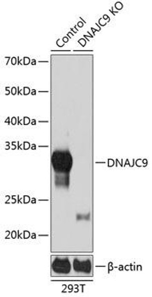 KO Validated Antibodies 2 Anti-DNAJC9 Antibody CAB19850KO Validated