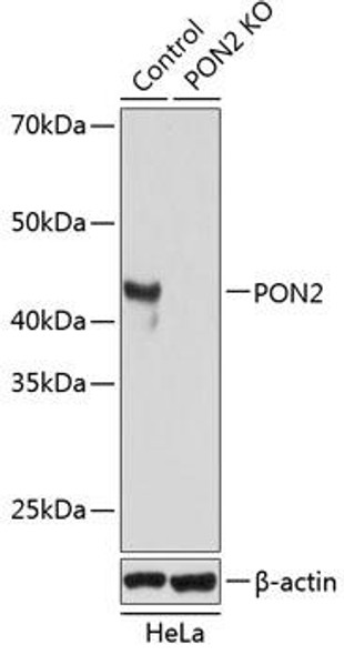 KO Validated Antibodies 2 Anti-PON2 Antibody CAB19852KO Validated