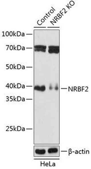 KO Validated Antibodies 2 Anti-NRBF2 Antibody CAB19856KO Validated