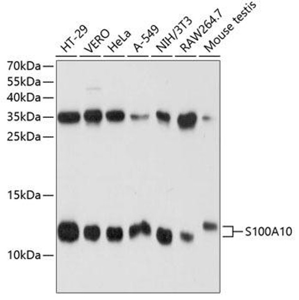 Cell Biology Antibodies 17 Anti-S100A10 Antibody CAB1987