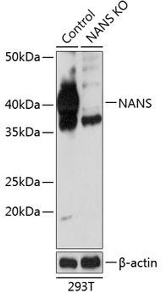 KO Validated Antibodies 2 Anti-NANS Antibody CAB19875KO Validated