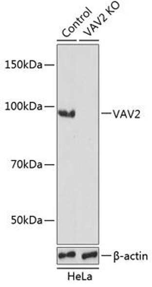 KO Validated Antibodies 2 Anti-VAV2 Antibody CAB19883KO Validated