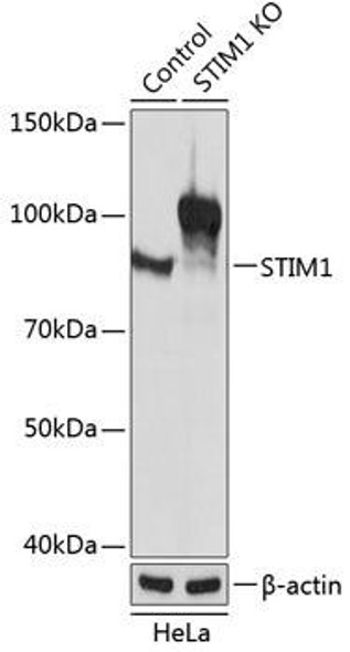 KO Validated Antibodies 2 Anti-STIM1 Antibody CAB19894KO Validated