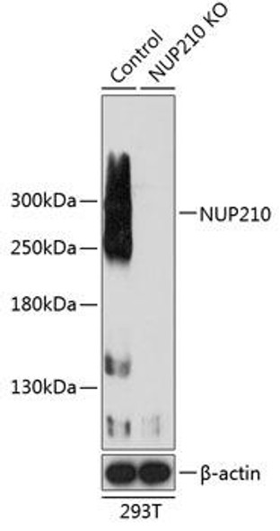 KO Validated Antibodies 2 Anti-NUP210 Antibody CAB19895KO Validated