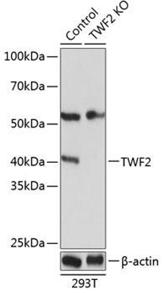 KO Validated Antibodies 2 Anti-TWF2 Antibody CAB19897KO Validated