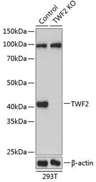 KO Validated Antibodies 2 Anti-TWF2 Antibody CAB19898KO Validated