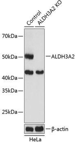 KO Validated Antibodies 2 Anti-ALDH3A2 Antibody CAB19899KO Validated