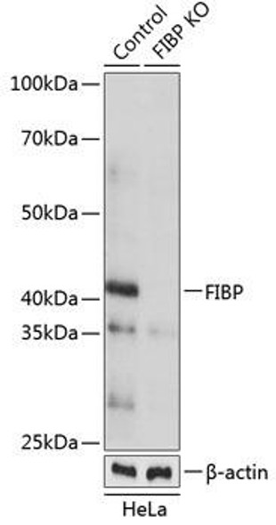 KO Validated Antibodies 2 Anti-FIBP Antibody CAB19908KO Validated
