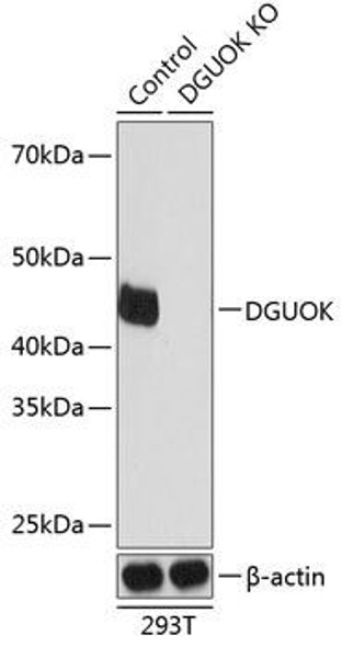 KO Validated Antibodies 2 Anti-DGUOK Antibody CAB19926KO Validated