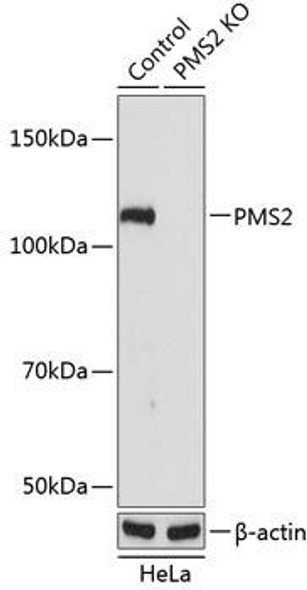 KO Validated Antibodies 2 Anti-PMS2 Antibody CAB19928KO Validated