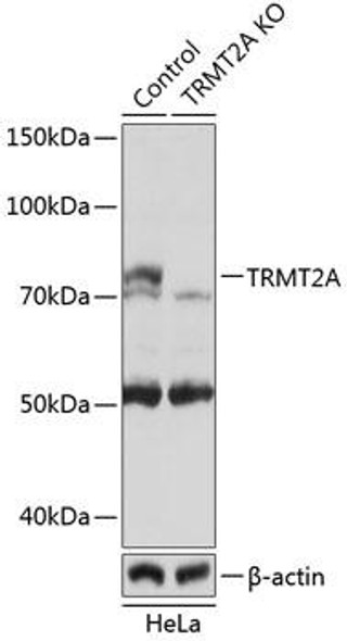 KO Validated Antibodies 2 Anti-TRMT2A Antibody CAB19929KO Validated