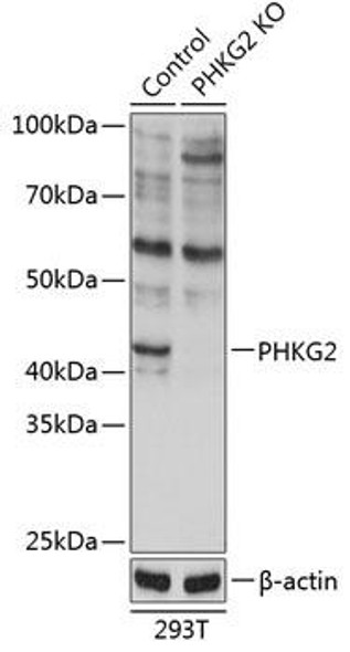 KO Validated Antibodies 2 Anti-PHKG2 Antibody CAB19934KO Validated