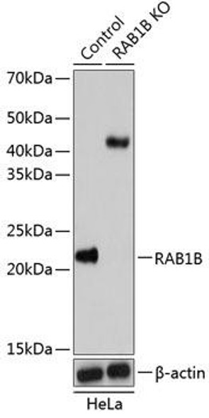 KO Validated Antibodies 2 Anti-RAB1B Antibody CAB19935KO Validated