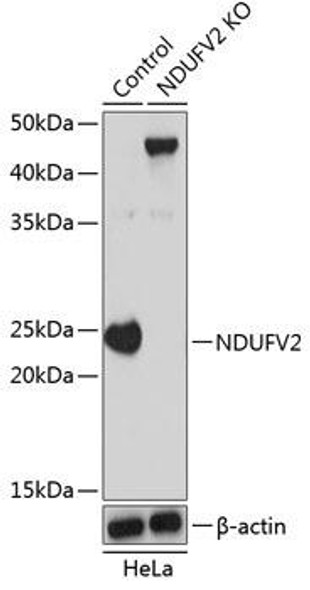 KO Validated Antibodies 2 Anti-NDUFV2 Antibody CAB19936KO Validated