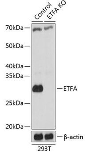 KO Validated Antibodies 2 Anti-ETFA Antibody CAB19937KO Validated