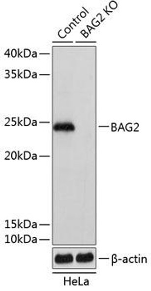 KO Validated Antibodies 2 Anti-BAG2 Antibody CAB19945KO Validated