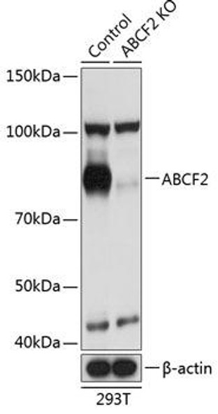 KO Validated Antibodies 2 Anti-ABCF2 Antibody CAB19949KO Validated