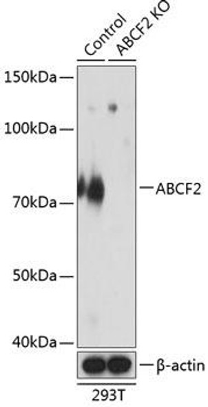 KO Validated Antibodies 2 Anti-ABCF2 Antibody CAB19950KO Validated