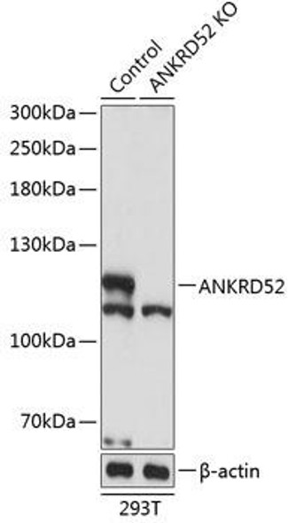 KO Validated Antibodies 2 Anti-ANKRD52 Antibody CAB19958KO Validated