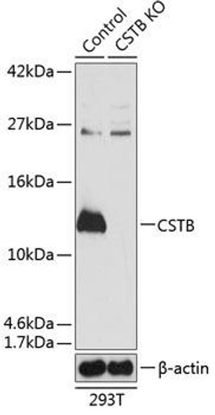 KO Validated Antibodies 2 Anti-CSTB Antibody CAB19961KO Validated