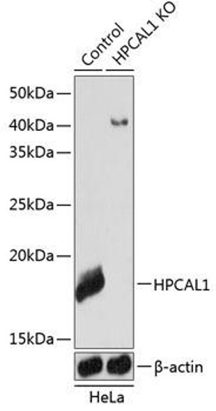 KO Validated Antibodies 2 Anti-HPCAL1 Antibody CAB19964KO Validated