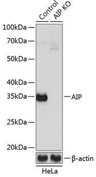 KO Validated Antibodies 2 Anti-AIP Antibody CAB19969KO Validated