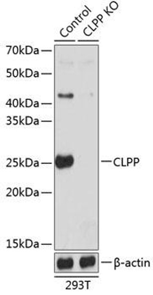 KO Validated Antibodies 2 Anti-CLPP Antibody CAB19975KO Validated