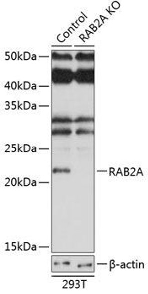 KO Validated Antibodies 2 Anti-RAB2A Antibody CAB19982KO Validated