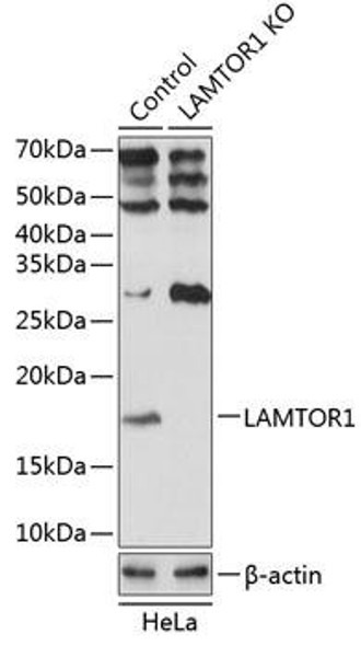 KO Validated Antibodies 2 Anti-LAMTOR1 Antibody CAB19983KO Validated