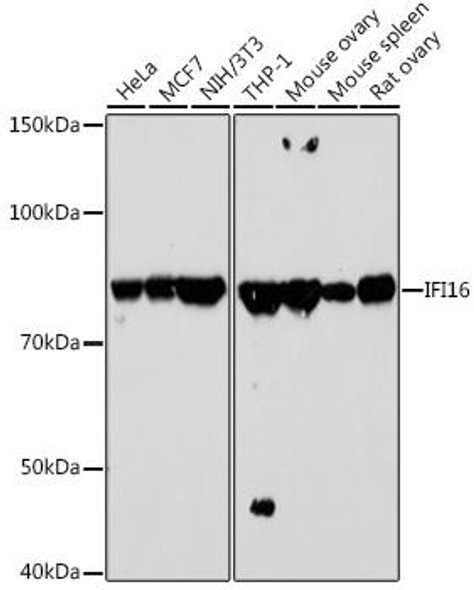 Cell Death Antibodies 2 Anti-IFI16 Antibody CAB2007