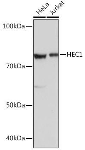 Cell Cycle Antibodies 2 Anti-HEC1 Antibody CAB2392