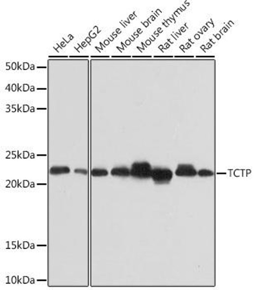 Cell Biology Antibodies 17 Anti-TCTP Antibody CAB2394