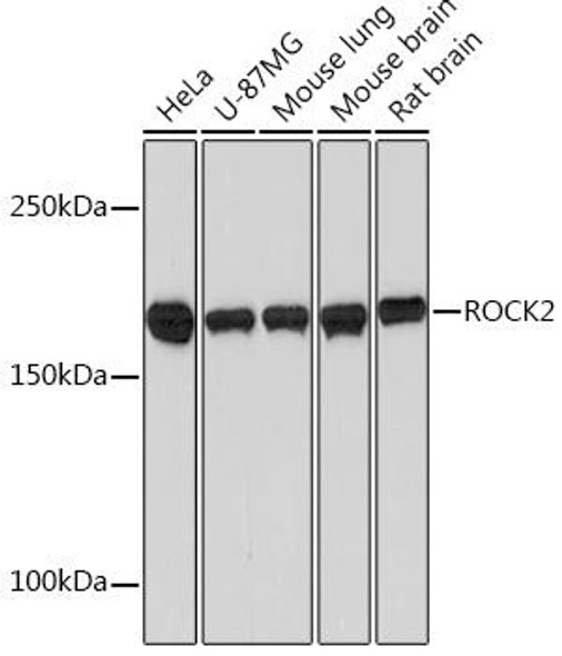 Cell Biology Antibodies 17 Anti-ROCK2 Antibody CAB2395