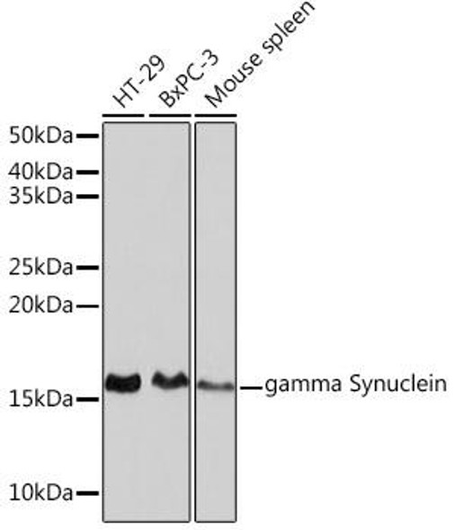 Cell Biology Antibodies 17 Anti-gamma Synuclein Antibody CAB2735