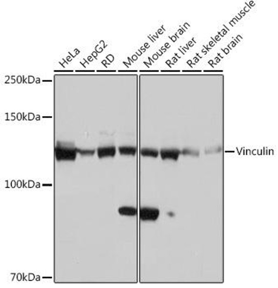 Cell Biology Antibodies 17 Anti-Vinculin Antibody CAB2752