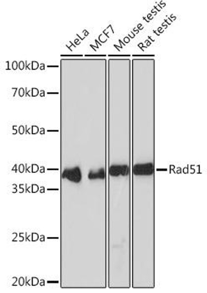 Epigenetics and Nuclear Signaling Antibodies 5 Anti-Rad51 Antibody CAB2829