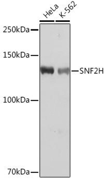 Cell Biology Antibodies 17 Anti-SNF2H Antibody CAB3539