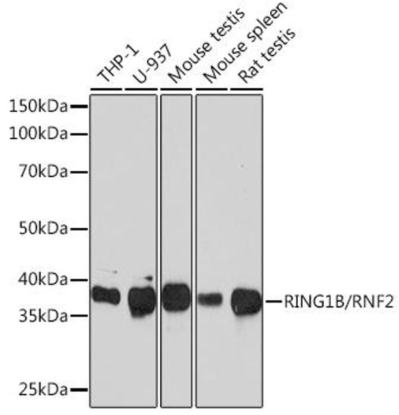 Epigenetics and Nuclear Signaling Antibodies 5 Anti-RING1B/RNF2 Antibody CAB3564