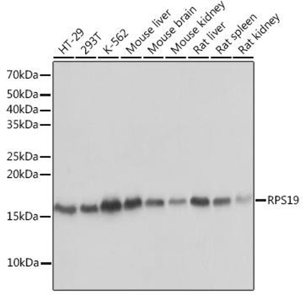 Cell Biology Antibodies 17 Anti-RPS19 Antibody CAB3675